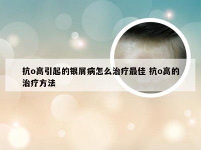 抗o高引起的银屑病怎么治疗最佳 抗o高的治疗方法