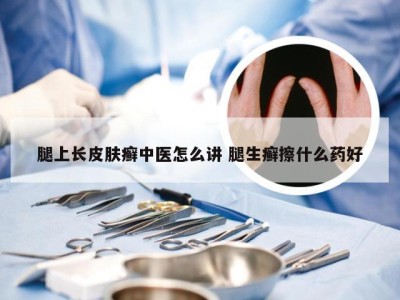 腿上长皮肤癣中医怎么讲 腿生癣擦什么药好