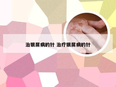 治银屑病的针 治疗银屑病的针