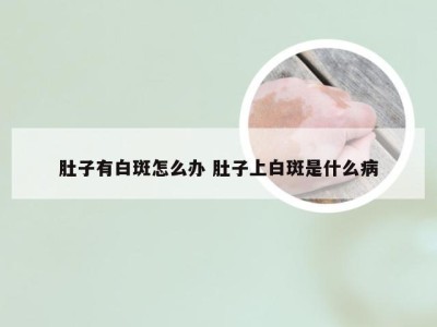 肚子有白斑怎么办 肚子上白斑是什么病