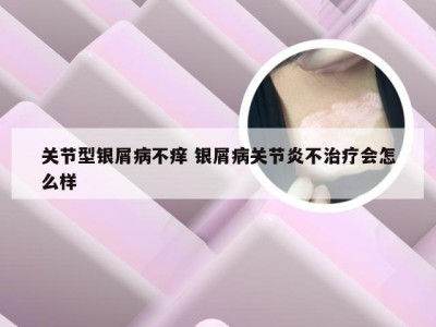 关节型银屑病不痒 银屑病关节炎不治疗会怎么样