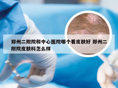 郑州二附院和中心医院哪个看皮肤好 郑州二附院皮肤科怎么样