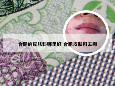 合肥的皮肤科哪里好 合肥皮肤科去哪