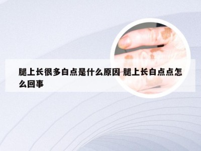 腿上长很多白点是什么原因 腿上长白点点怎么回事