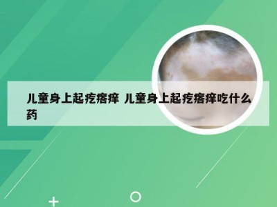 儿童身上起疙瘩痒 儿童身上起疙瘩痒吃什么药