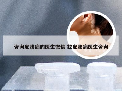 咨询皮肤病的医生微信 找皮肤病医生咨询