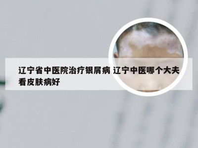 辽宁省中医院治疗银屑病 辽宁中医哪个大夫看皮肤病好