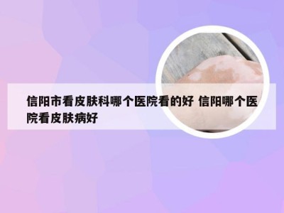 信阳市看皮肤科哪个医院看的好 信阳哪个医院看皮肤病好