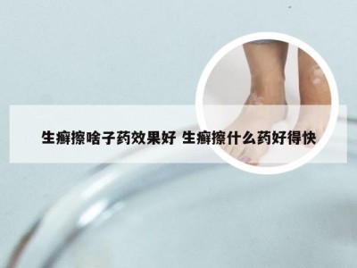 生癣擦啥子药效果好 生癣擦什么药好得快