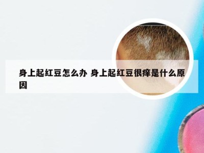 身上起红豆怎么办 身上起红豆很痒是什么原因