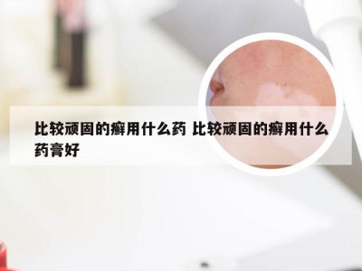 比较顽固的癣用什么药 比较顽固的癣用什么药膏好