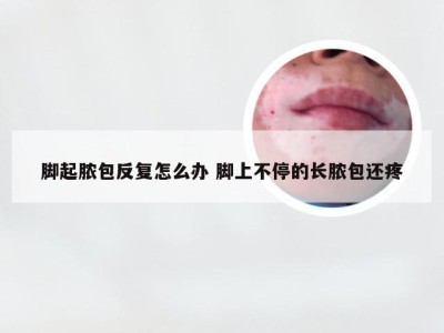 脚起脓包反复怎么办 脚上不停的长脓包还疼