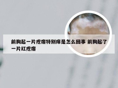 前胸起一片疙瘩特别痒是怎么回事 前胸起了一片红疙瘩