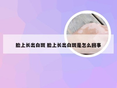 脸上长出白斑 脸上长出白斑是怎么回事