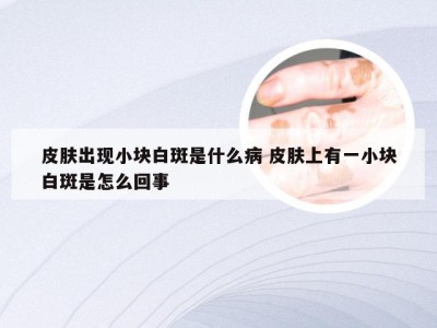 皮肤出现小块白斑是什么病 皮肤上有一小块白斑是怎么回事