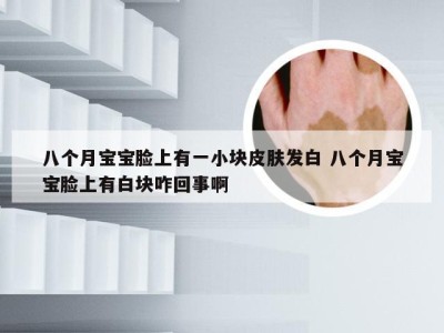 八个月宝宝脸上有一小块皮肤发白 八个月宝宝脸上有白块咋回事啊