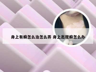 身上有癣怎么治怎么弄 身上出现癣怎么办