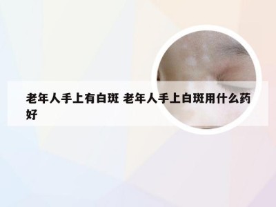 老年人手上有白斑 老年人手上白斑用什么药好