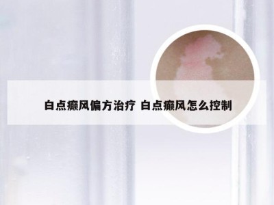 白点癫风偏方治疗 白点癫风怎么控制