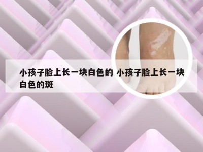 小孩子脸上长一块白色的 小孩子脸上长一块白色的斑