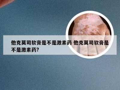 他克莫司软膏是不是激素药 他克莫司软膏是不是激素药?