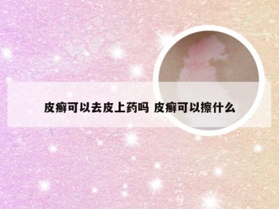 皮癣可以去皮上药吗 皮癣可以擦什么