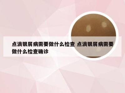 点滴银屑病需要做什么检查 点滴银屑病需要做什么检查确诊