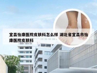 宜昌怡康医院皮肤科怎么样 湖北省宜昌市怡康医院皮肤科