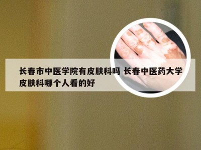 长春市中医学院有皮肤科吗 长春中医药大学皮肤科哪个人看的好