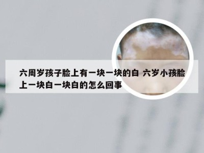 六周岁孩子脸上有一块一块的白 六岁小孩脸上一块白一块白的怎么回事