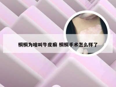 桐桐为啥叫牛皮癣 桐桐手术怎么样了