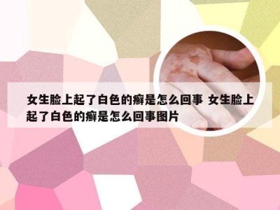 女生脸上起了白色的癣是怎么回事 女生脸上起了白色的癣是怎么回事图片