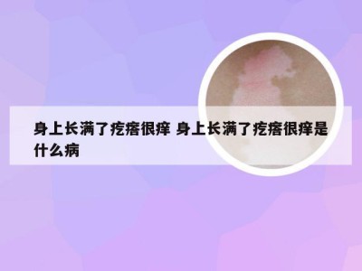 身上长满了疙瘩很痒 身上长满了疙瘩很痒是什么病