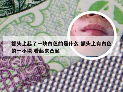 额头上起了一块白色的是什么 额头上有白色的一小块 看起来凸起