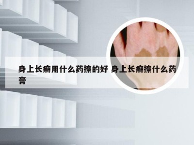 身上长癣用什么药擦的好 身上长癣擦什么药膏