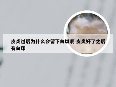 皮炎过后为什么会留下白斑啊 皮炎好了之后有白印