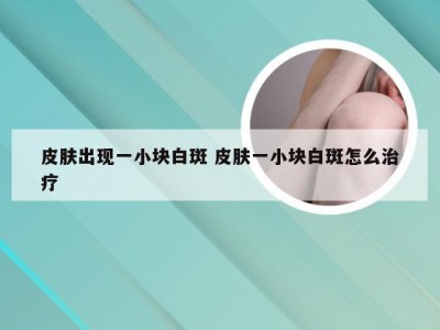 皮肤出现一小块白斑 皮肤一小块白斑怎么治疗