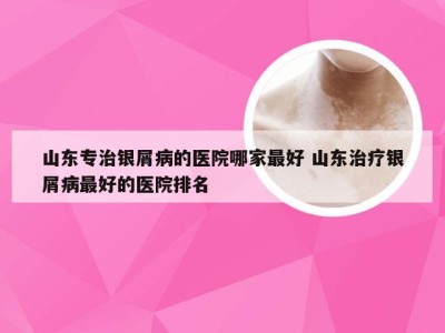 山东专治银屑病的医院哪家最好 山东治疗银屑病最好的医院排名