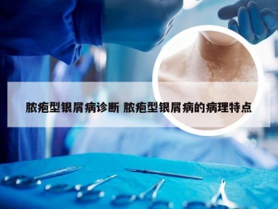 脓疱型银屑病诊断 脓疱型银屑病的病理特点