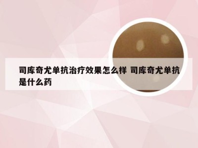 司库奇尤单抗治疗效果怎么样 司库奇尤单抗是什么药