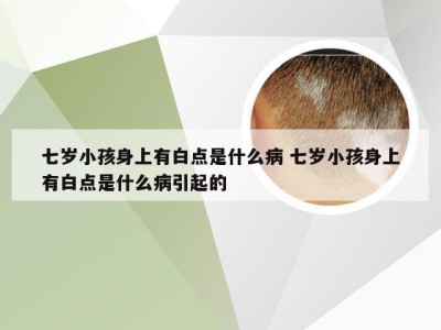 七岁小孩身上有白点是什么病 七岁小孩身上有白点是什么病引起的