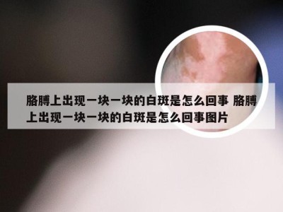 胳膊上出现一块一块的白斑是怎么回事 胳膊上出现一块一块的白斑是怎么回事图片