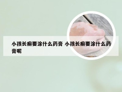 小孩长癣要涂什么药膏 小孩长癣要涂什么药膏呢