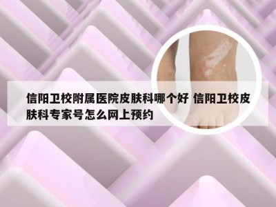 信阳卫校附属医院皮肤科哪个好 信阳卫校皮肤科专家号怎么网上预约