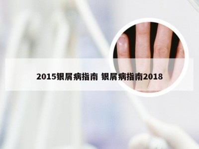 2015银屑病指南 银屑病指南2018