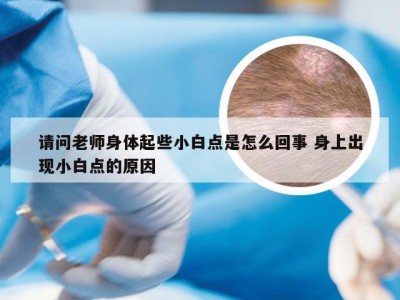 请问老师身体起些小白点是怎么回事 身上出现小白点的原因