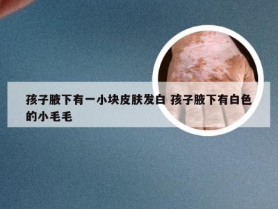 孩子腋下有一小块皮肤发白 孩子腋下有白色的小毛毛