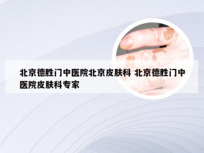 北京德胜门中医院北京皮肤科 北京德胜门中医院皮肤科专家