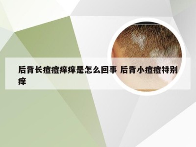 后背长痘痘痒痒是怎么回事 后背小痘痘特别痒