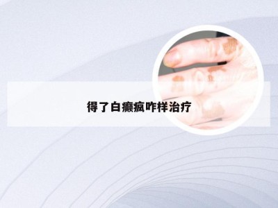 得了白癫疯咋样治疗